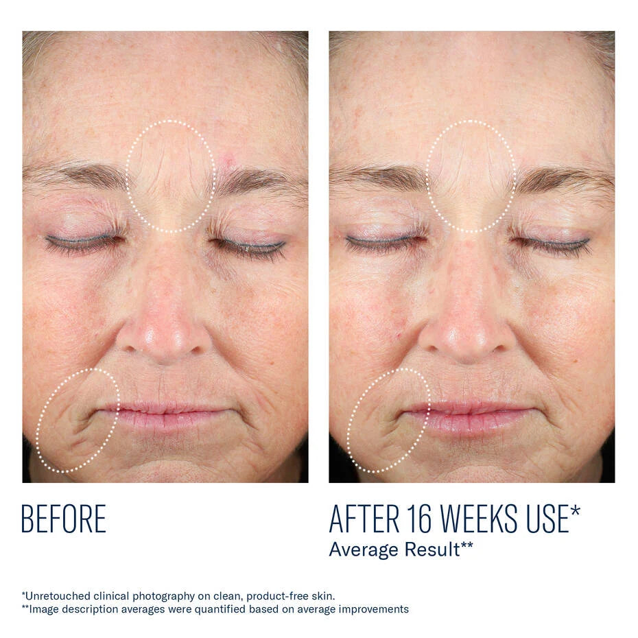 Mystro Revive Renewing Serum