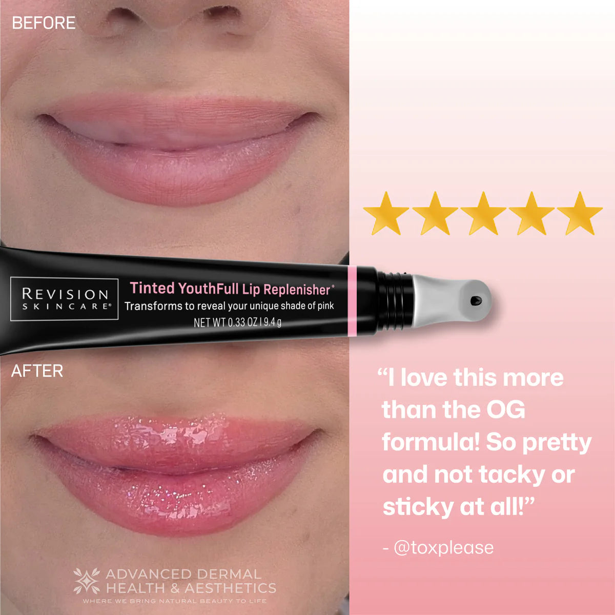 Tinted YouthFull Lip Replenisher®