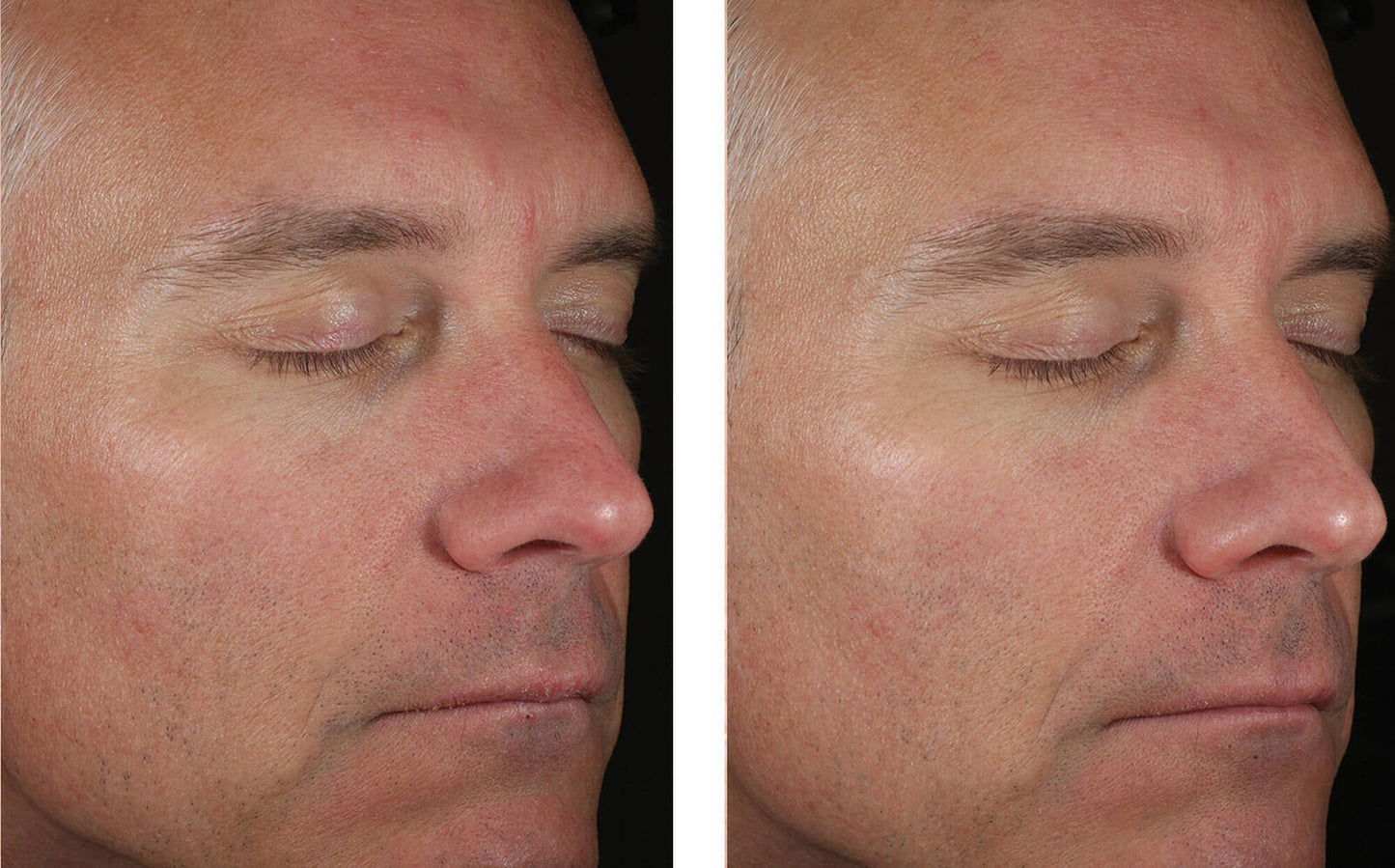 Solo Hydrating Defense Men