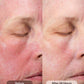 CMT Post-Procedure Cream®